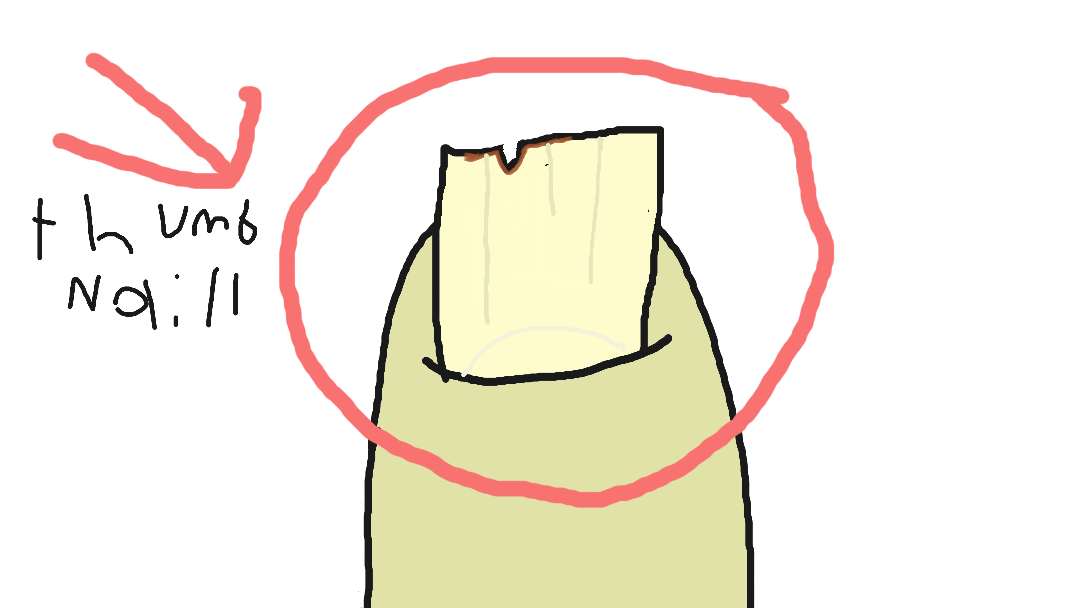 This is a drawing of a thumb nail with a red circle to show you where the nail is.